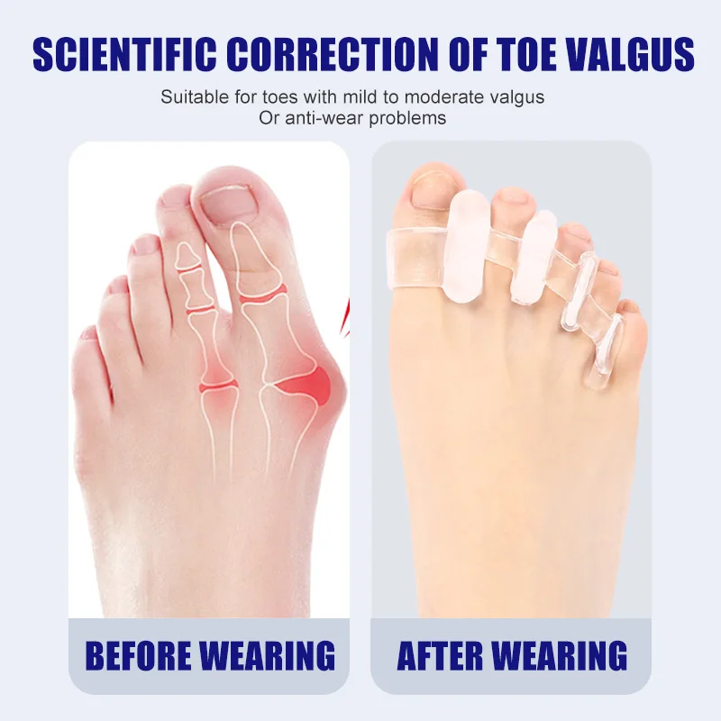 1 Pair Silicone Toe Separator  - Toe Separator Silicon 评论和价格
