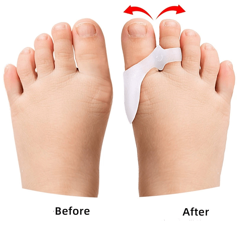 1/2/3Pairs Children's Gel Toe  - Toe Separator Silicon 评论和价格