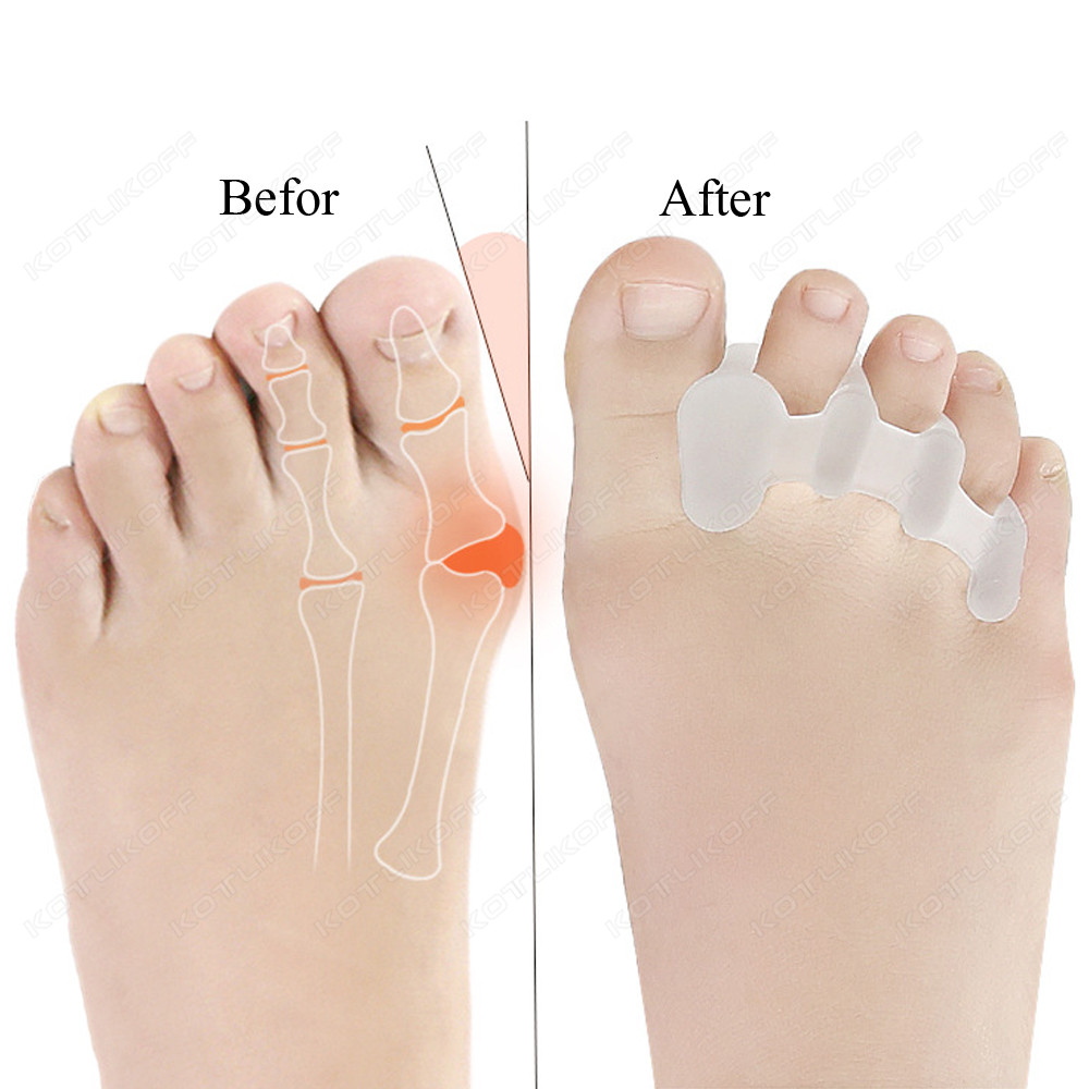 Toe Protective Toes Separator  - Toe Separator Silicon 评论和价格