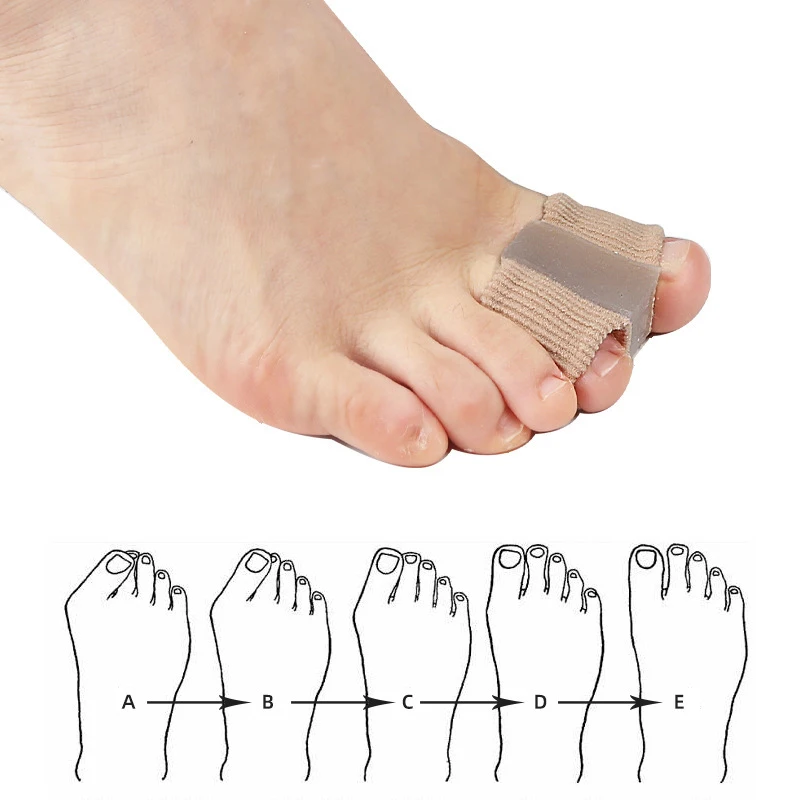 Gel Bunion Toe Separators W/Fa - Toe Separator Silicon 评论和价格